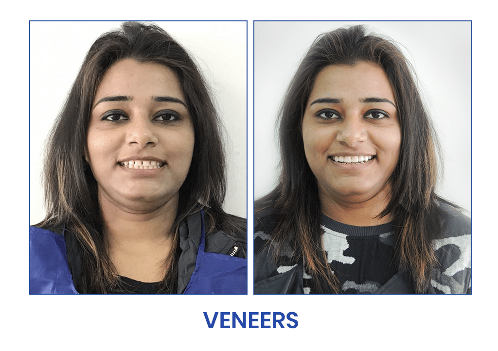 Dental Cosmetic Clinic - Dr Shobit sethi